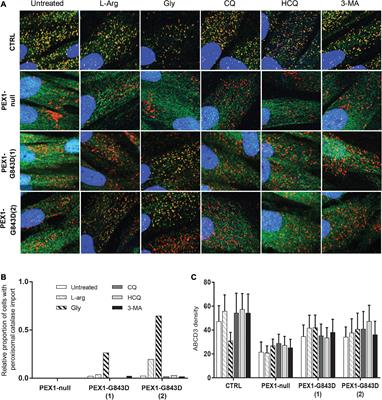 Autophagy Inhibitors Do Not Restore Peroxisomal Functions in Cells With the Most Common Peroxisome Biogenesis Defect